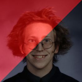 nick normal